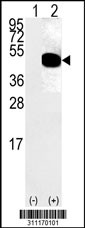 Western blot analysis of his-tag DUSP6 (arrow) using his tag antibody. 293 cell lysates (2 ug/lane) either nontransfected (Lane 1) or transiently transfected with the DUSP6 gene