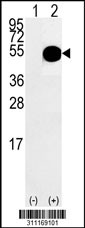 Western blot analysis of his-tag DOM3Z (arrow) using his tag antibody. 293 cell lysates (2 ug/lane) either nontransfected (Lane 1) or transiently transfected with the DOM3Z gene