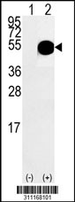 Western blot analysis of his-tag DCTN2 (arrow) using his tag antibody. 293 cell lysates (2 ug/lane) either nontransfected (Lane 1) or transiently transfected with the DCTN2 gene