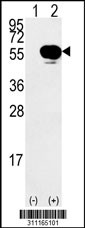 Western blot analysis of his-tag BMP4 (arrow) using his tag antibody. 293 cell lysates (2 ug/lane) either nontransfected (Lane 1) or transiently transfected with the BMP4 gene