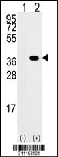Western blot analysis of his-tag SNX6 (arrow) using his tag antibody. 293 cell lysates (2 ug/lane) either nontransfected (Lane 1) or transiently transfected with the SNX6 gene