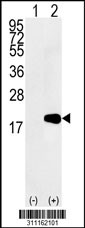 Western blot analysis of his-tag REG1B (arrow) using his tag antibody. 293 cell lysates (2 ug/lane) either nontransfected (Lane 1) or transiently transfected with the REG1B gene