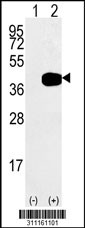 Western blot analysis of his-tag PHYH (arrow) using his tag antibody. 293 cell lysates (2 ug/lane) either nontransfected (Lane 1) or transiently transfected with the PHYH gene