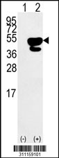 Western blot analysis of his-tag LRG1 (arrow) using his tag antibody. 293 cell lysates (2 ug/lane) either nontransfected (Lane 1) or transiently transfected with the LRG1 gene
