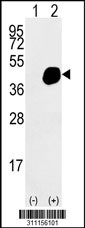 Western blot analysis of his-tag FLCN (arrow) using his tag antibody. 293 cell lysates (2 ug/lane) either nontransfected (Lane 1) or transiently transfected with the FLCN gene