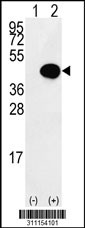 Western blot analysis of his-tag FCGR2A (arrow) using his tag antibody. 293 cell lysates (2 ug/lane) either nontransfected (Lane 1) or transiently transfected with the FCGR2A gene