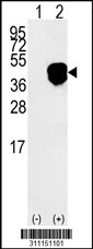 Western blot analysis of his-tag EIF2B2 (arrow) using his tag antibody. 293 cell lysates (2 ug/lane) either nontransfected (Lane 1) or transiently transfected with the EIF2B2 gene