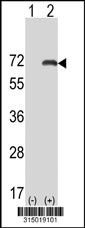 Western blot analysis of his-tag COIL (arrow) using his tag antibody. 293T cell lysates (2 ug/lane) either nontransfected (Lane 1) or transiently transfected with the COIL gene‘