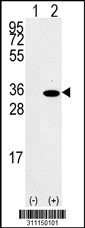 Western blot analysis of his-tag CYB5R1 (arrow) using his tag antibody. 293 cell lysates (2 ug/lane) either nontransfected (Lane 1) or transiently transfected with the CYB5R1 gene