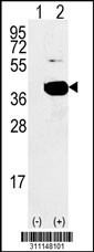Western blot analysis of his-tag CTSK (arrow) using his tag antibody. 293 cell lysates (2 ug/lane) either nontransfected (Lane 1) or transiently transfected with the CTSK gene