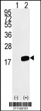 Western blot analysis of his-tag CLASP1 (arrow) using his tag antibody. 293 cell lysates (2 ug/lane) either nontransfected (Lane 1) or transiently transfected with the CLASP1 gene