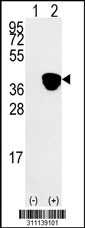 Western blot analysis of his-tag ART5 (arrow) using his tag antibody. 293 cell lysates (2 ug/lane) either nontransfected (Lane 1) or transiently transfected with the ART5 gene