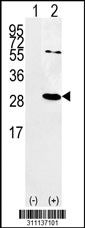 Western blot analysis of his-tag APBB1IP (arrow) using his tag antibody. 293 cell lysates (2 ug/lane) either nontransfected (Lane 1) or transiently transfected with the APBB1IP gene