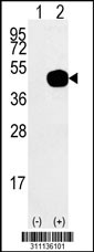 Western blot analysis of his-tag ANTXR1 (arrow) using his tag antibody. 293 cell lysates (2 ug/lane) either nontransfected (Lane 1) or transiently transfected with the ANTXR1 gene