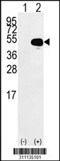 Western blot analysis of his-tag ACTR3B (arrow) using his tag antibody. 293 cell lysates (2 ug/lane) either nontransfected (Lane 1) or transiently transfected with the ACTR3B gene