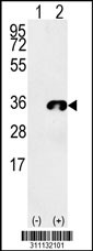 Western blot analysis of his-tag UROS (arrow) using his tag antibody. 293 cell lysates (2 ug/lane) either nontransfected (Lane 1) or transiently transfected with the UROS gene