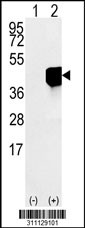 Western blot analysis of his-tag TFPT (arrow) using his tag antibody. 293 cell lysates (2 ug/lane) either nontransfected (Lane 1) or transiently transfected with the TFPT gene