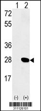 Western blot analysis of his-tag RGS4 (arrow) using his tag antibody. 293 cell lysates (2 ug/lane) either nontransfected (Lane 1) or transiently transfected with the RGS4 gene
