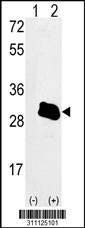Western blot analysis of his-tag RCVRN (arrow) using his tag antibody. 293 cell lysates (2 ug/lane) either nontransfected (Lane 1) or transiently transfected with the RCVRN gene