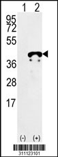 Western blot analysis of his-tag PCNA (arrow) using his tag antibody. 293 cell lysates (2 ug/lane) either nontransfected (Lane 1) or transiently transfected with the PCNA gene