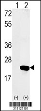 Western blot analysis of his-tag MOBKL1B (arrow) using his tag antibody. 293 cell lysates (2 ug/lane) either nontransfected (Lane 1) or transiently transfected with the MOBKL1B gene