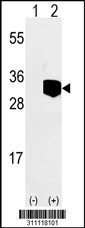 Western blot analysis of his-tag GSTO1 (arrow) using his tag antibody. 293 cell lysates (2 ug/lane) either nontransfected (Lane 1) or transiently transfected with the GSTO1 gene
