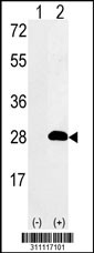 Western blot analysis of his-tag GOSR2 (arrow) using his tag antibody. 293 cell lysates (2 ug/lane) either nontransfected (Lane 1) or transiently transfected with the GOSR2 gene