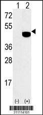 Western blot analysis of his-tag GCAT (arrow) using his tag antibody. 293 cell lysates (2 ug/lane) either nontransfected (Lane 1) or transiently transfected with the GCAT gene
