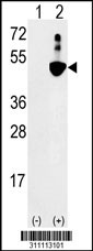 Western blot analysis of his-tag ENO3 (arrow) using his tag antibody. 293 cell lysates (2 ug/lane) either nontransfected (Lane 1) or transiently transfected with the ENO3 gene