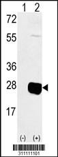 Western blot analysis of his-tag DLK2 (arrow) using his tag antibody. 293 cell lysates (2 ug/lane) either nontransfected (Lane 1) or transiently transfected with the DLK2 gene