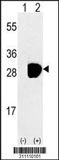 Western blot analysis of his-tag DCXR (arrow) using his tag antibody. 293 cell lysates (2 ug/lane) either nontransfected (Lane 1) or transiently transfected with the DCXR gene