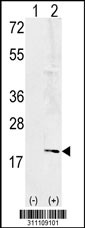 Western blot analysis of his-tag CYP19A1 (arrow) using his tag antibody. 293 cell lysates (2 ug/lane) either nontransfected (Lane 1) or transiently transfected with the CYP19A1 gene