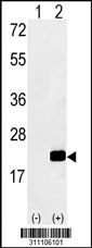 Western blot analysis of his-tag CDIPT (arrow) using his tag antibody. 293 cell lysates (2 ug/lane) either nontransfected (Lane 1) or transiently transfected with the CDIPT gene