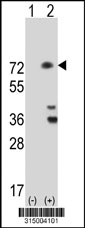 Western blot analysis of his-tag SOCS5 (arrow) using his tag antibody. 293T cell lysates (2 ug/lane) either nontransfected (Lane 1) or transiently transfected with the SOCS5 gene‘