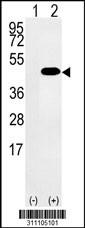 Western blot analysis of his-tag CDCA3 (arrow) using his tag antibody. 293 cell lysates (2 ug/lane) either nontransfected (Lane 1) or transiently transfected with the CDCA3 gene