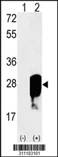 Western blot analysis of his-tag VSNL1 (arrow) using his tag antibody. 293 cell lysates (2 ug/lane) either nontransfected (Lane 1) or transiently transfected with the VSNL1 gene