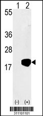 Western blot analysis of his-tag UBE2V1 (arrow) using his tag antibody. 293 cell lysates (2 ug/lane) either nontransfected (Lane 1) or transiently transfected with the UBE2V1 gene