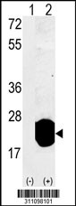 Western blot analysis of his-tag SOD1 (arrow) using his tag antibody. 293 cell lysates (2 ug/lane) either nontransfected (Lane 1) or transiently transfected with the SOD1 gene