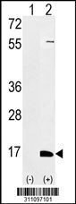 Western blot analysis of his-tag RPS27A (arrow) using his tag antibody. 293 cell lysates (2 ug/lane) either nontransfected (Lane 1) or transiently transfected with the RPS27A gene