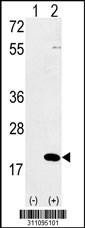 Western blot analysis of his-tag RBM3 (arrow) using his tag antibody. 293 cell lysates (2 ug/lane) either nontransfected (Lane 1) or transiently transfected with the RBM3 gene