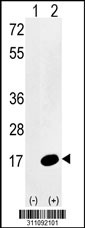 Western blot analysis of his-tag PFN1 (arrow) using his tag antibody. 293 cell lysates (2 ug/lane) either nontransfected (Lane 1) or transiently transfected with the PFN1 gene