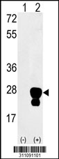 Western blot analysis of his-tag NPC2 (arrow) using his tag antibody. 293 cell lysates (2 ug/lane) either nontransfected (Lane 1) or transiently transfected with the NPC2 gene