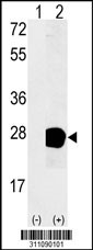 Western blot analysis of his-tag NIP7 (arrow) using his tag antibody. 293 cell lysates (2 ug/lane) either nontransfected (Lane 1) or transiently transfected with the NIP7 gene