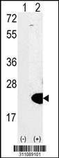 Western blot analysis of his-tag MPV17 (arrow) using his tag antibody. 293 cell lysates (2 ug/lane) either nontransfected (Lane 1) or transiently transfected with the MPV17 gene