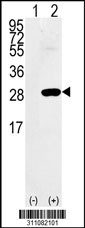 Western blot analysis of his-tag GLO1 (arrow) using his tag antibody. 293 cell lysates (2 ug/lane) either nontransfected (Lane 1) or transiently transfected with the GLO1 gene