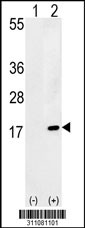 Western blot analysis of his-tag FKBP2 (arrow) using his tag antibody. 293 cell lysates (2 ug/lane) either nontransfected (Lane 1) or transiently transfected with the FKBP2 gene