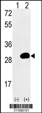 Western blot analysis of his-tag DHFR (arrow) using his tag antibody. 293 cell lysates (2 ug/lane) either nontransfected (Lane 1) or transiently transfected with the DHFR gene