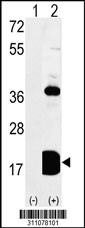 Western blot analysis of his-tag CD247 (arrow) using his tag antibody. 293 cell lysates (2 ug/lane) either nontransfected (Lane 1) or transiently transfected with the CD247 gene
