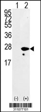 Western blot analysis of his-tag CAV1 (arrow) using his tag antibody. 293 cell lysates (2 ug/lane) either nontransfected (Lane 1) or transiently transfected with the CAV1 gene