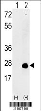 Western blot analysis of his-tag BAALC (arrow) using his tag antibody. 293 cell lysates (2 ug/lane) either nontransfected (Lane 1) or transiently transfected with the BAALC gene